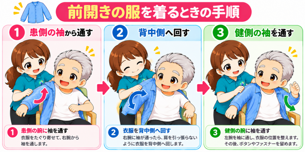 片麻痺がある高齢者の前開きの服を着る更衣介助手順。患側の右腕から袖を通し、衣服を背中側へ回してから、健側の左腕を通す3ステップをイラストで解説。